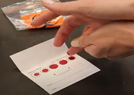 Dried blood spot card